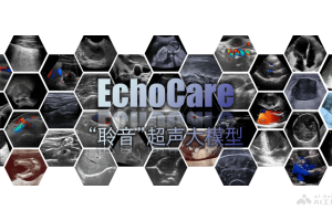 聆音EchoCare – 香港中科院推出的超声大模型