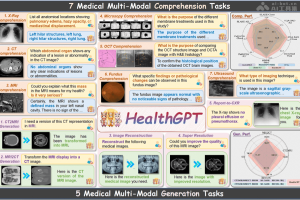 HealthGPT – 浙大联合阿里等机构推出的医学视觉语言模型