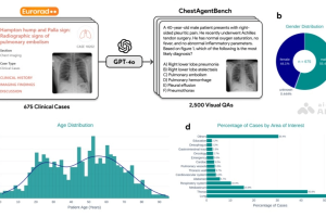 MedRAX – AI医学推理Agent，用于胸部X光检查和解决复杂医学问题